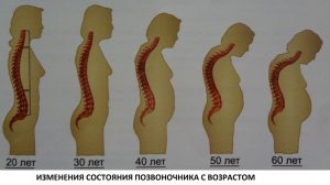 Как спасти спину? Методики омоложения и восстановления